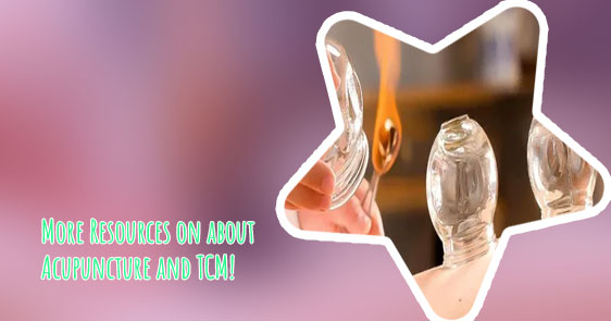 Cupping and massage near me